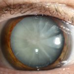 Qual é a fruta deliciosa que ajuda a prevenir o glaucoma, as cataratas nos olhos e elimina o colesterol «ruim»?